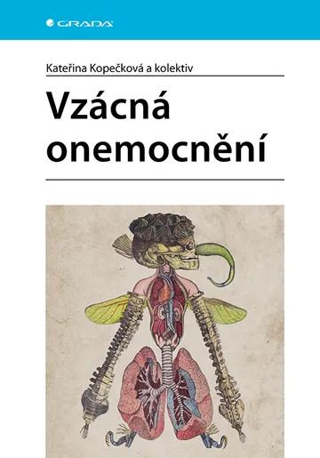 Vzácná onemocnění