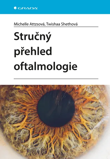 Stručný přehled oftalmologie