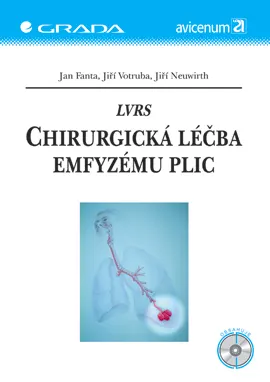 LVRS – Chirurgická léčba emfyzému plic