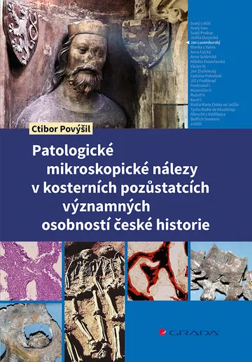 Patologické mikroskopické nálezy v kosterních pozůstatcích významných osobností české historie – obálka